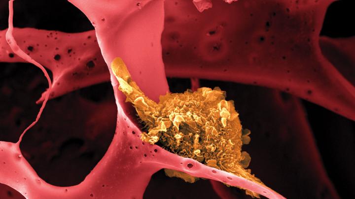 Image shows a dendritic cell (shown in yellow) attached to a man-made polymer lattice inside a pill-sized implantable device.